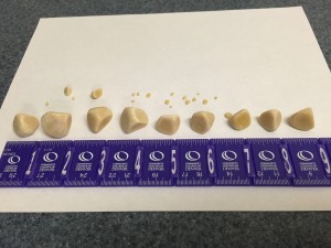 These bladder stones (uroliths) were all removed from Nikki